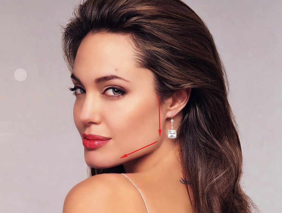 Эффект от процедуры "Профиль Джоли" Эффект от процедуры "Профиль Джоли"